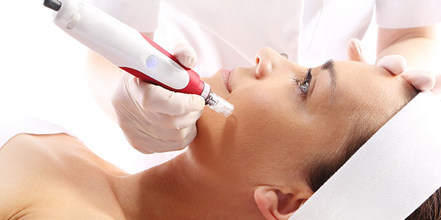 RF Microneedling